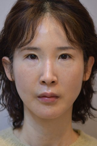 수술 전