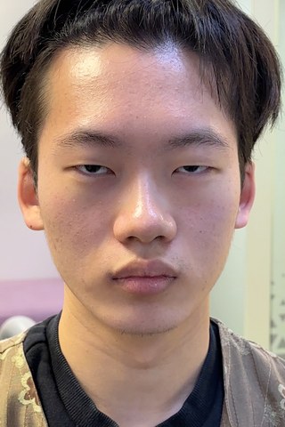 수술 전