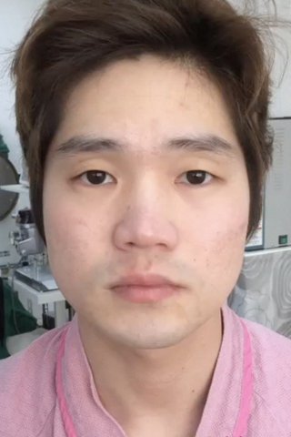 수술 전