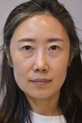 수술 전