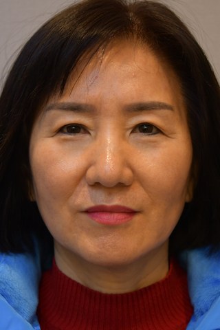 수술 전