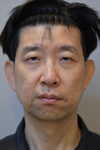 수술 전