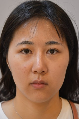수술 전