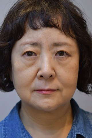 수술 전