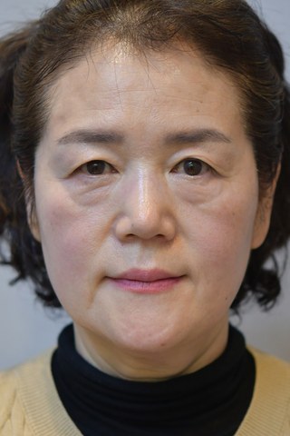 수술 전