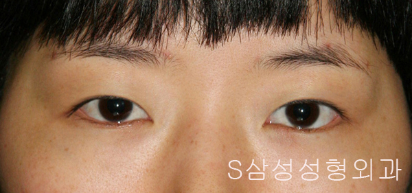 e_eye02