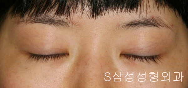 e_eye02