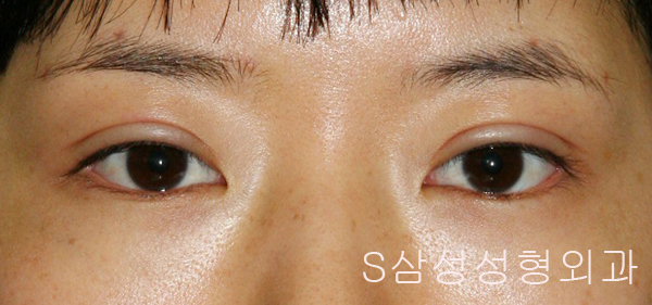 e_eye02