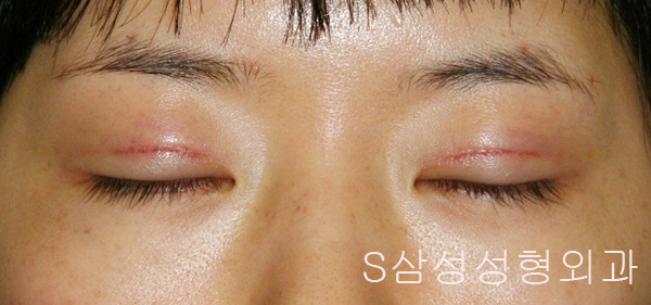 e_eye02
