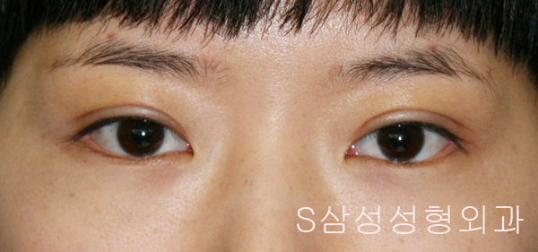 e_eye02