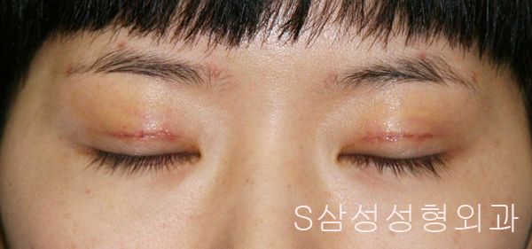 e_eye02