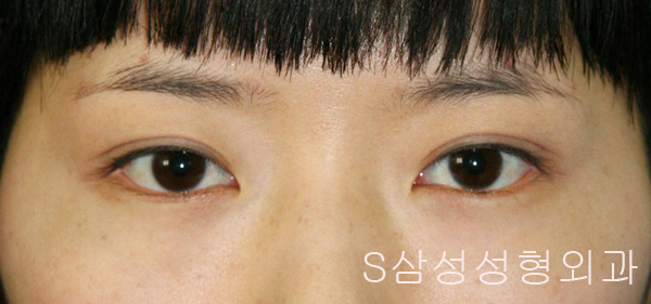e_eye02