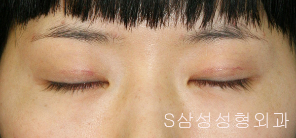 e_eye02