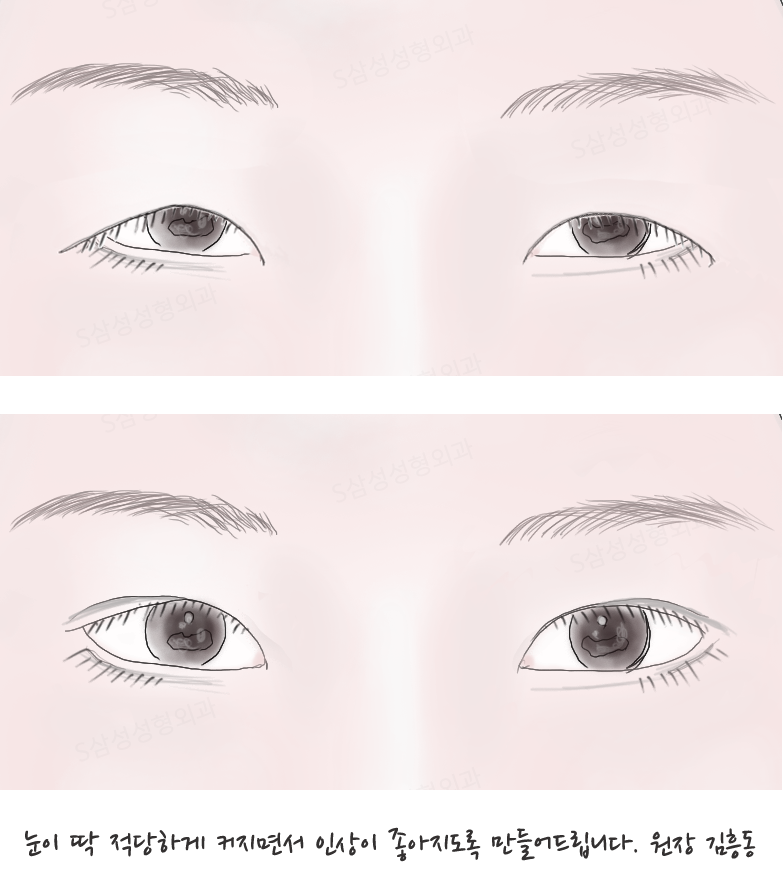 대구성형외과