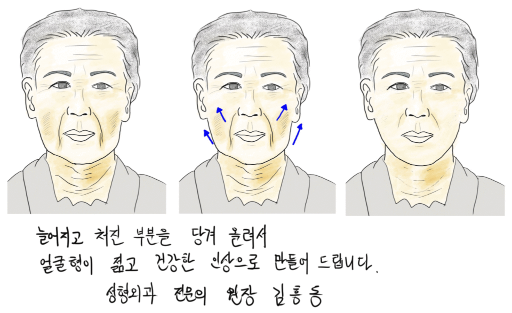 e_aging