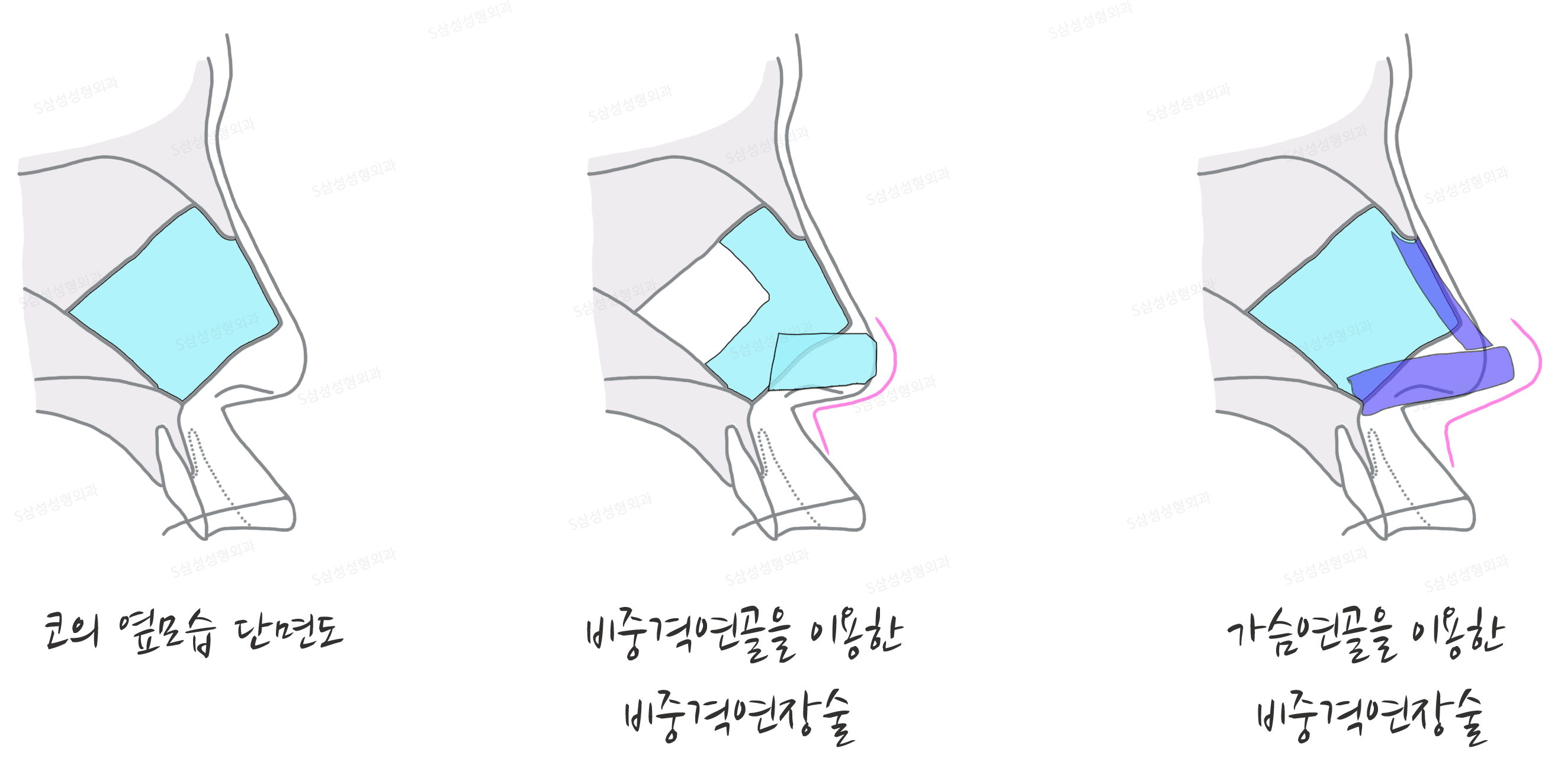 대구성형외과