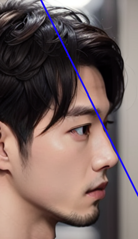 대구휜코성형