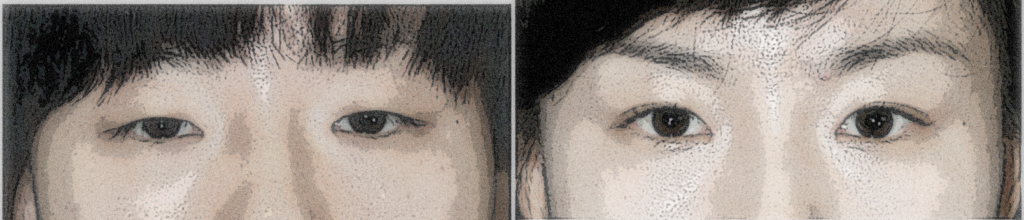 대구쌍수