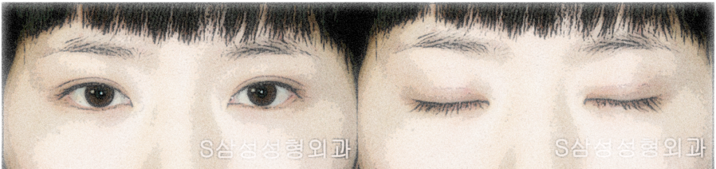 대구쌍수