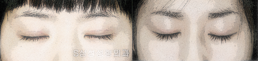대구쌍수