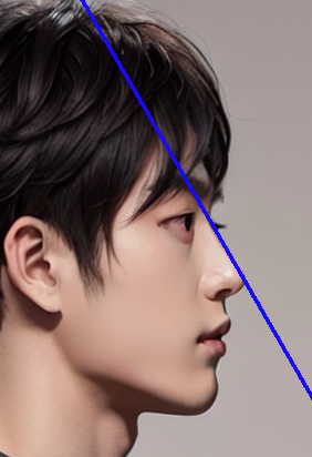 대구메부리코성형