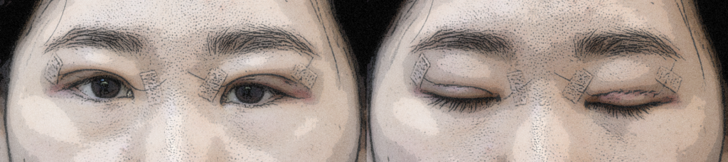 대구쌍수