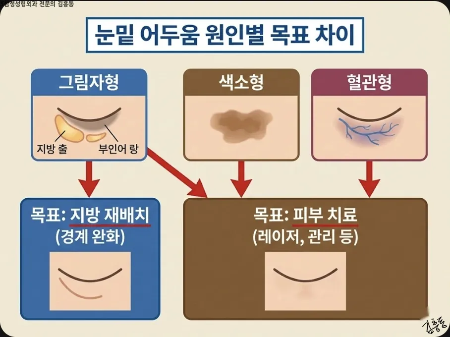눈밑 어두움 원인별 목표 차이