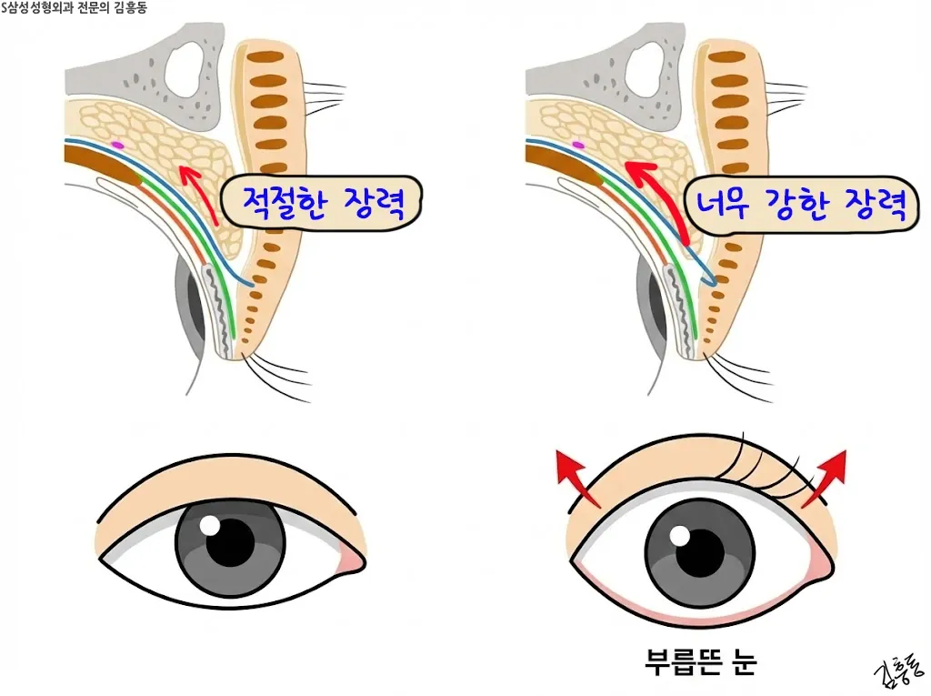 고정 높이와 아래보기에서의 지연 느낌