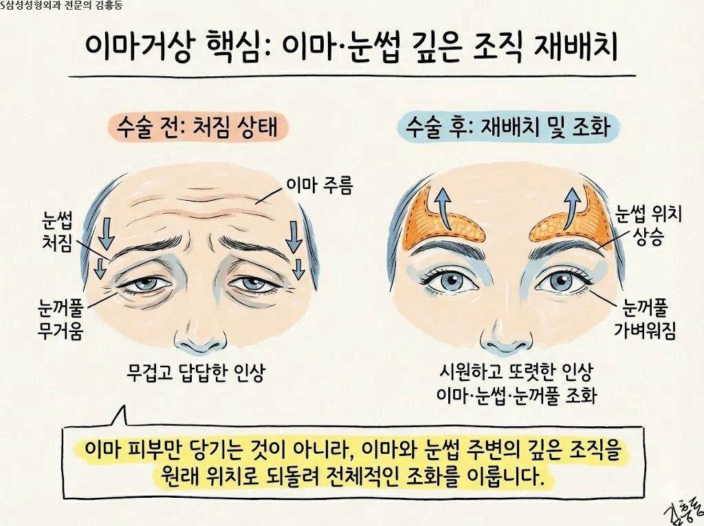 대구안면거상은 무엇을 당기는 수술인가 — 피부와 깊은층의 역할 구분