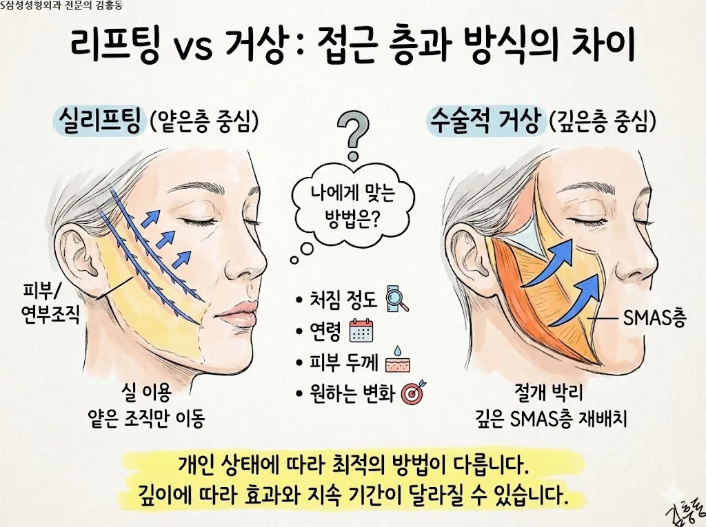 대구안면거상은 무엇을 당기는 수술인가 — 피부와 깊은층의 역할 구분