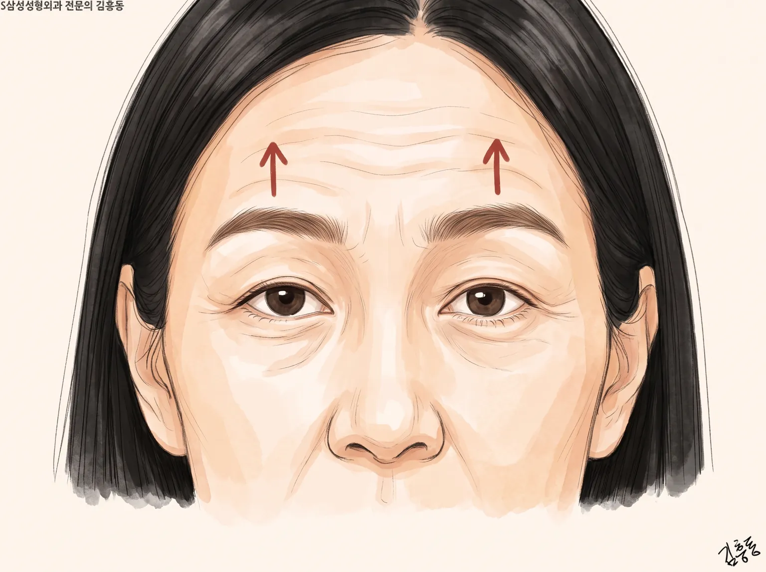 이마에 가로 주름이 지고 두 눈썹 위에 위로 향한 화살표가 하나씩 있는 얼굴 그림