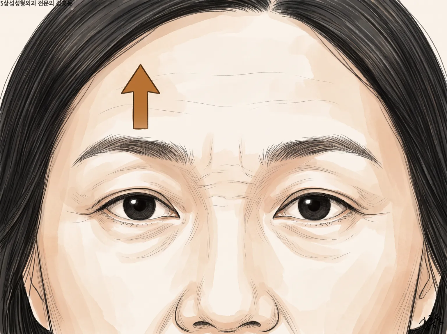한쪽 눈썹 위 이마에 위로 향한 화살표 하나가 그려진 이마와 두 눈 그림