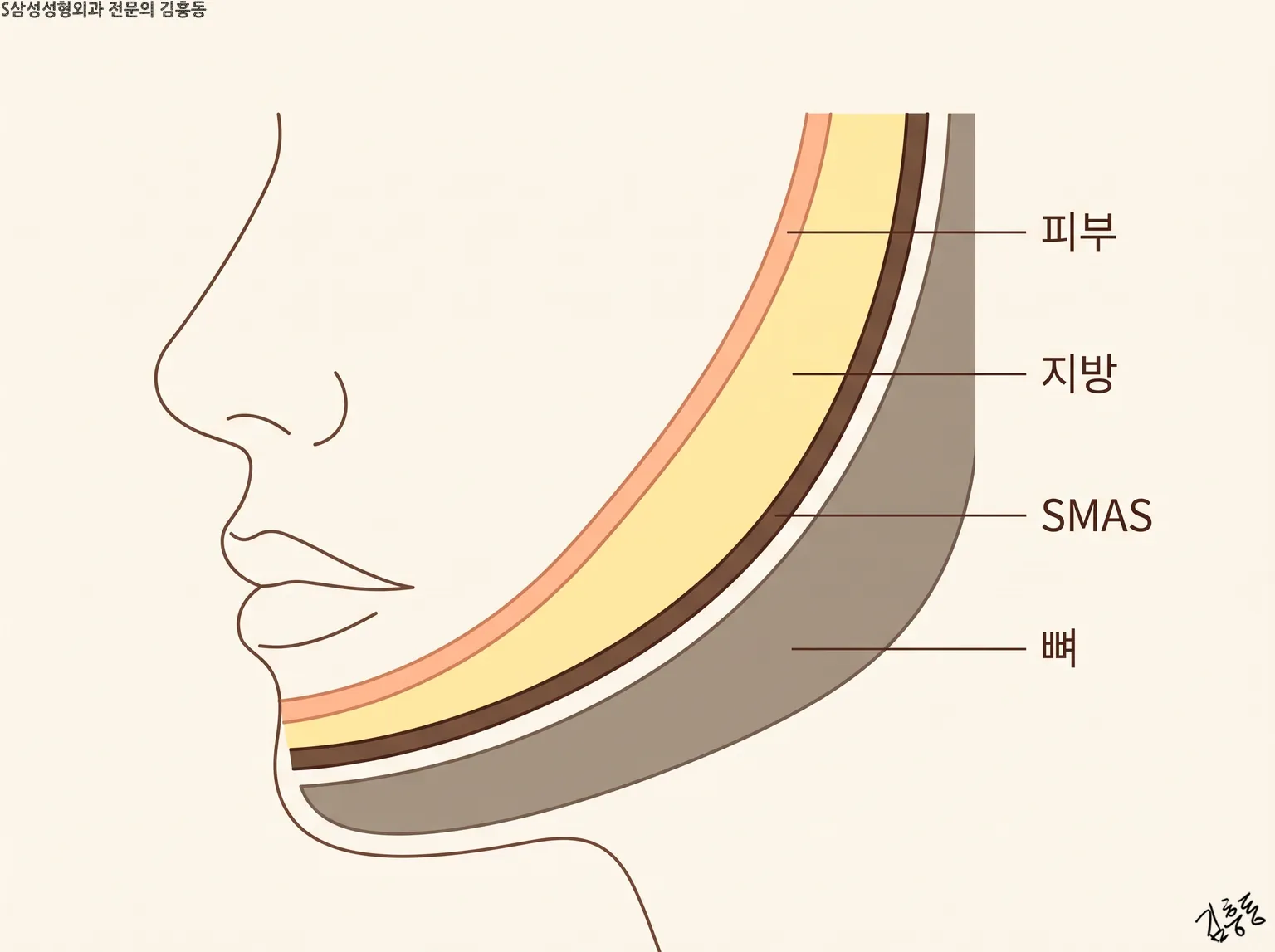피부 · 지방 · SMAS · 뼈 이름표가 붙은, 옆얼굴 선 옆의 볼 층 단면 그림