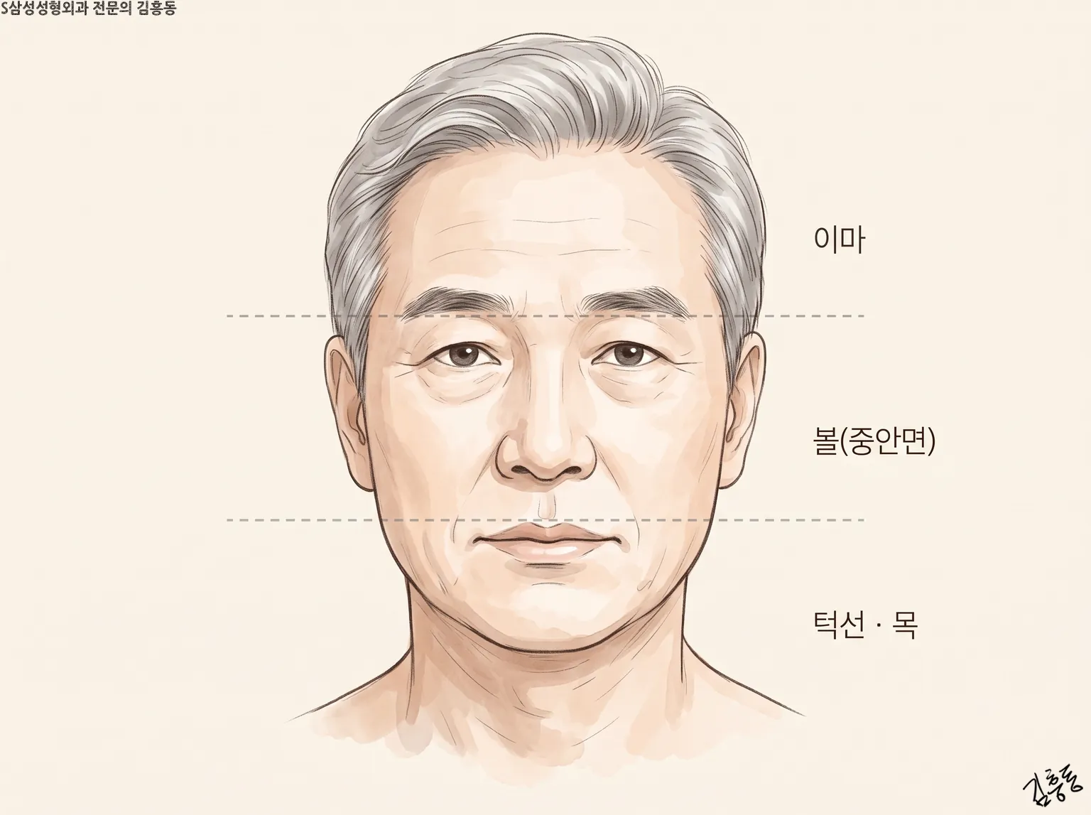 점선 두 줄로 이마 · 볼(중안면) · 턱선과 목 세 구역을 나눈 남성 정면 얼굴 그림