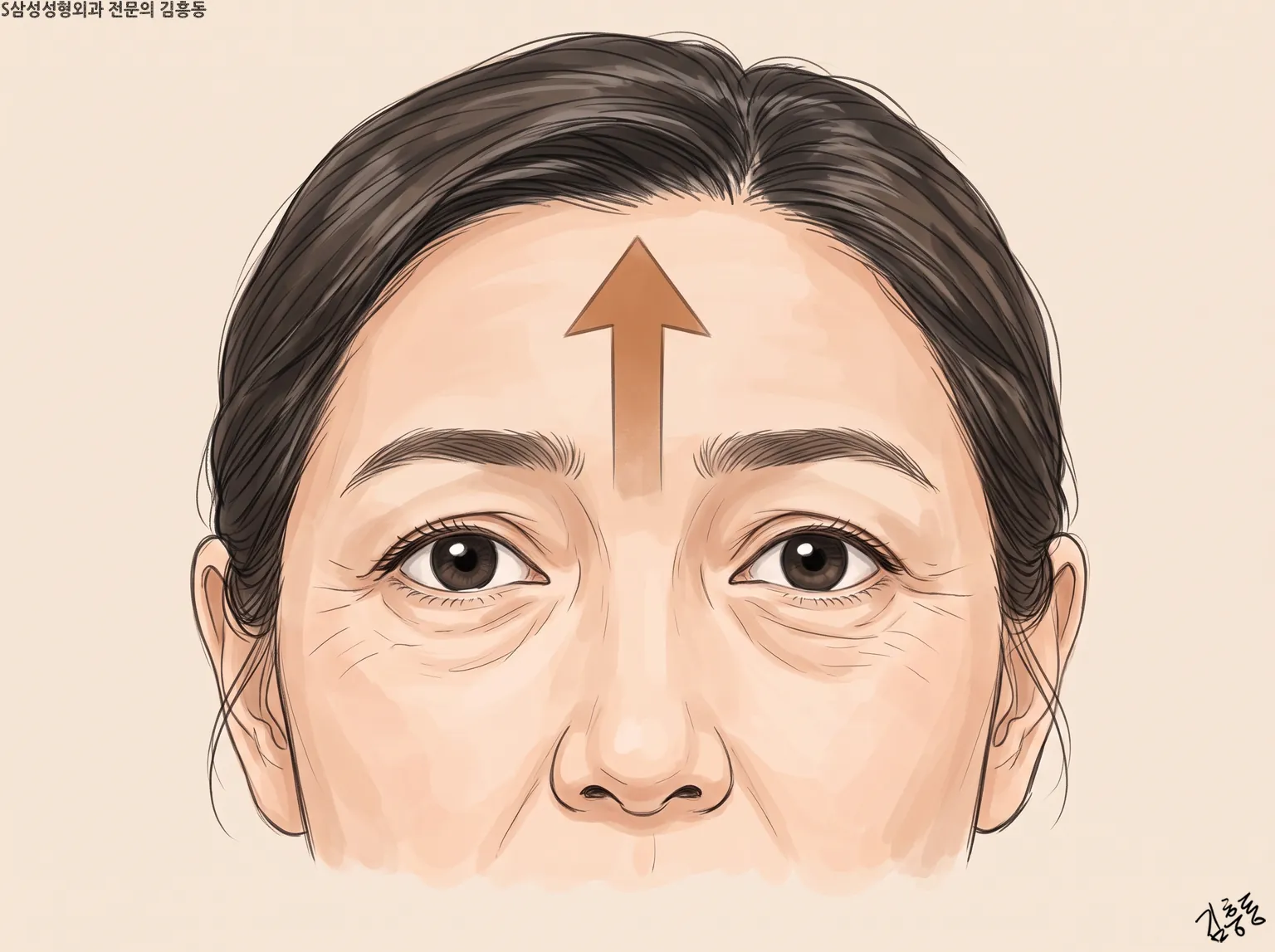 미간에서 이마 가운데로 위를 향한 큰 화살표가 그려진 여성 얼굴 윗부분 그림