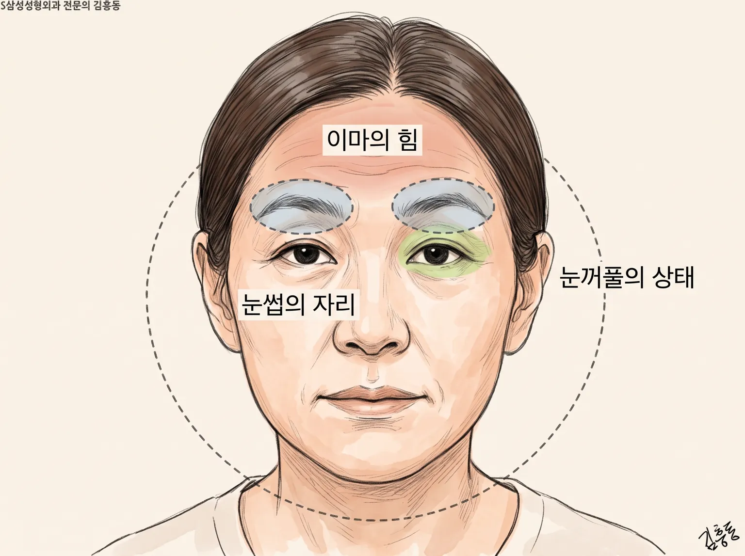 이마의 힘 · 눈썹의 자리 · 눈꺼풀의 상태 이름표와 눈썹 · 눈 둘레 표시가 있는 여성 정면 얼굴 그림