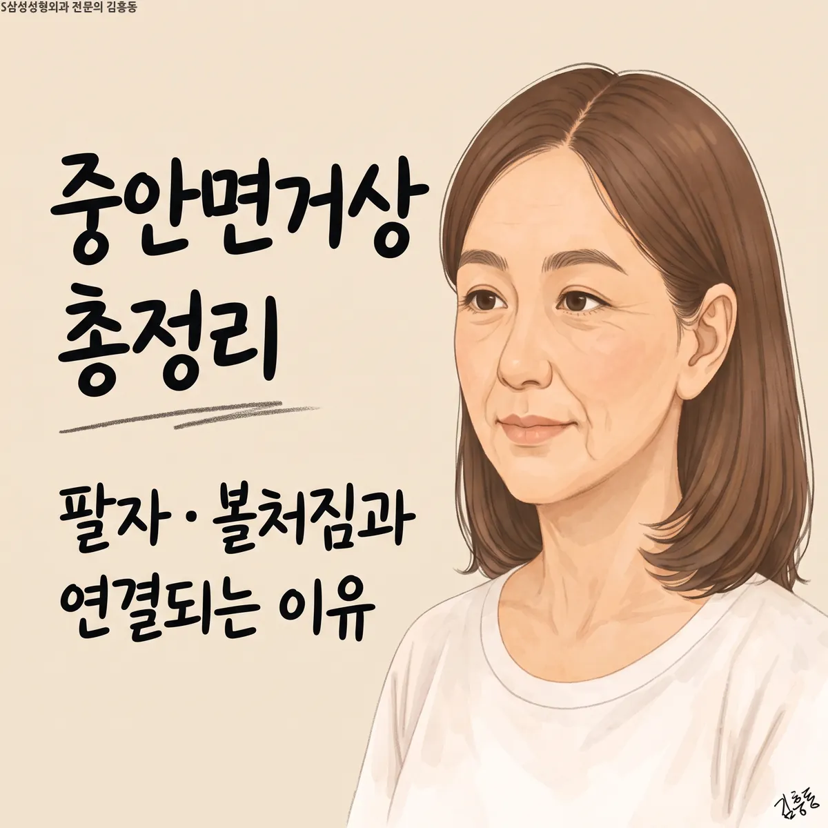 「중안면거상 총정리 팔자 · 볼처짐과 연결되는 이유」라는 제목이 적힌, 비스듬히 본 여성 얼굴 그림