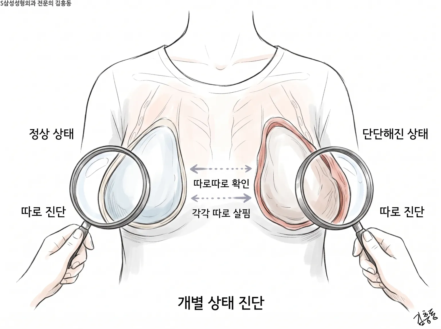 나란히 놓인 두 보형물을 돋보기로 하나씩 따로 살피는 모습