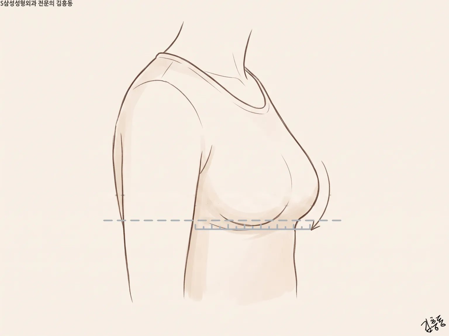 옆에서 본 상반신 윤곽선에 가슴 밑선 높이의 가로 점선과 작은 눈금을 둔 그림