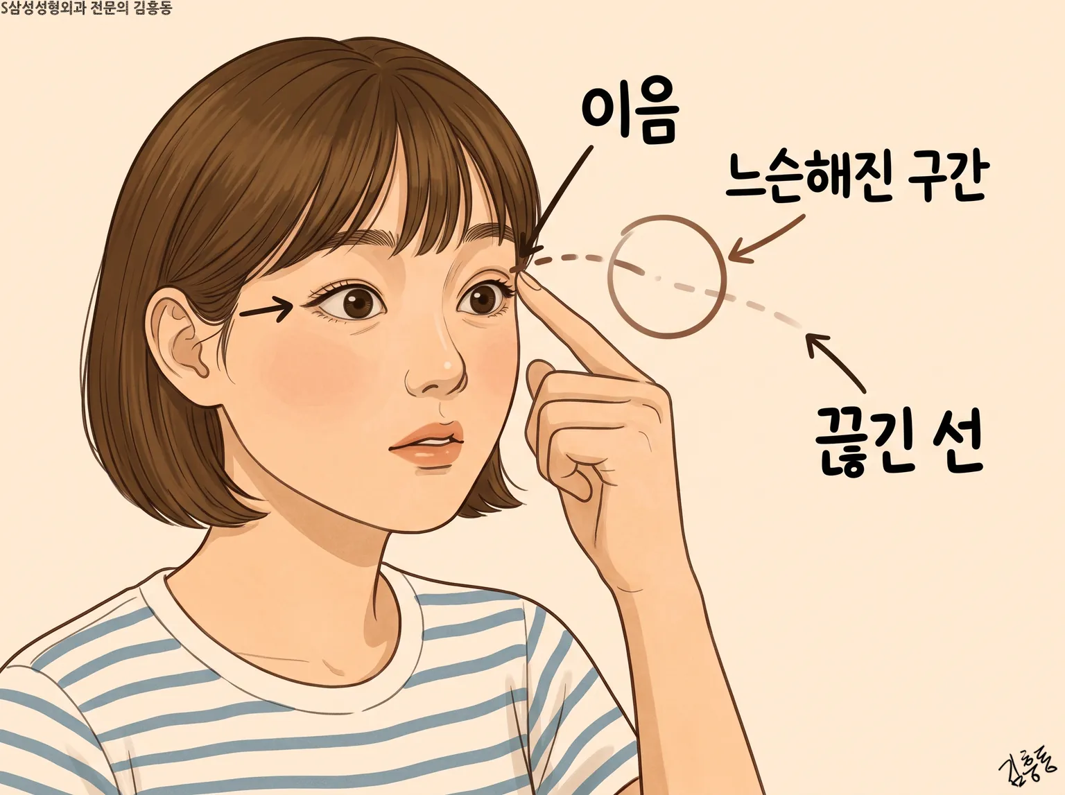 이음 · 느슨해진 구간 · 끊긴 선 이름표를 단, 눈썹 끝을 짚은 단발 여성 그림