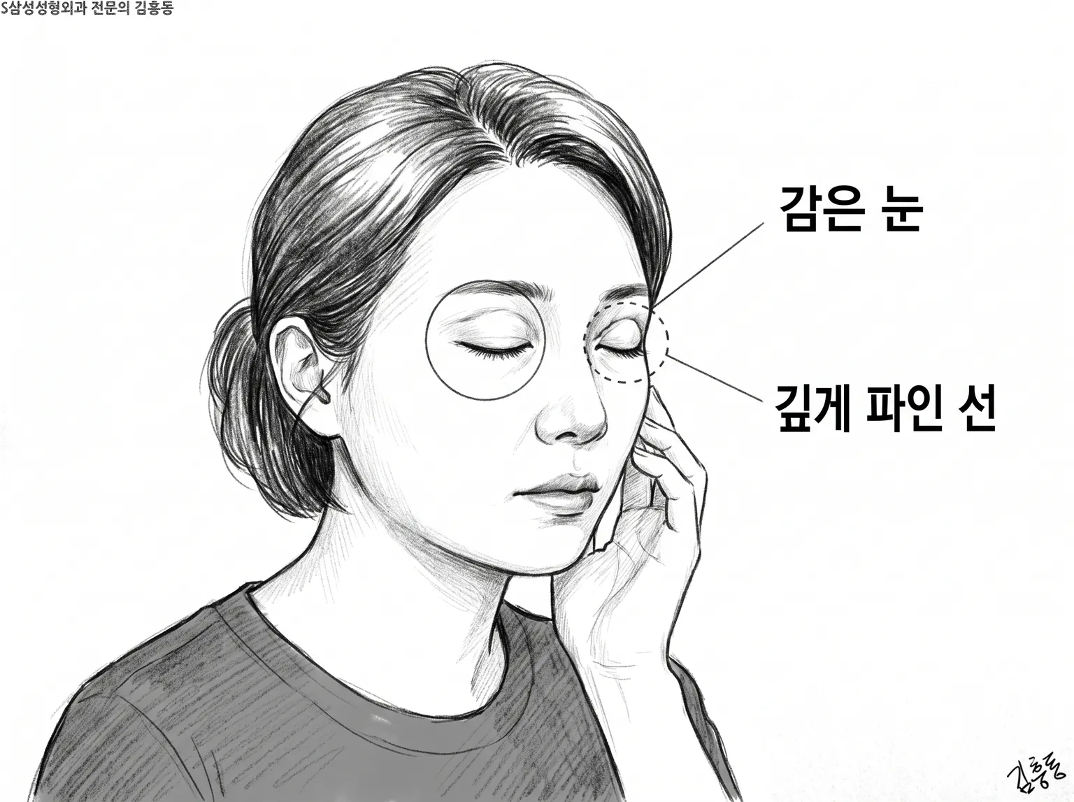 감은 눈 · 깊게 파인 선 이름표를 단, 눈을 감고 얼굴에 손을 댄 여성 연필 그림