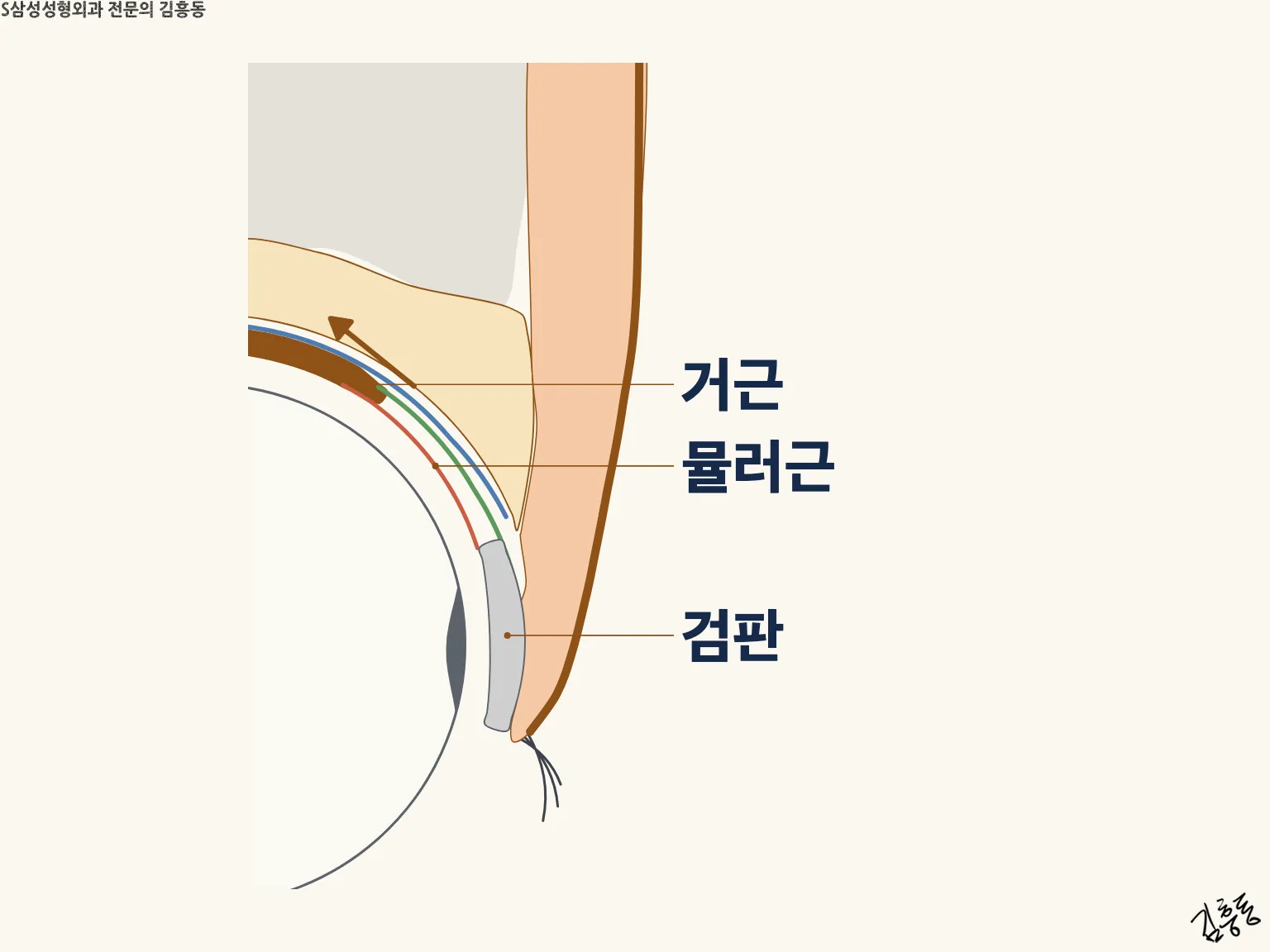 거근 · 뮬러근 · 검판 이름표가 붙은, 윗눈꺼풀을 들어 올리는 방향을 그린 단면 그림