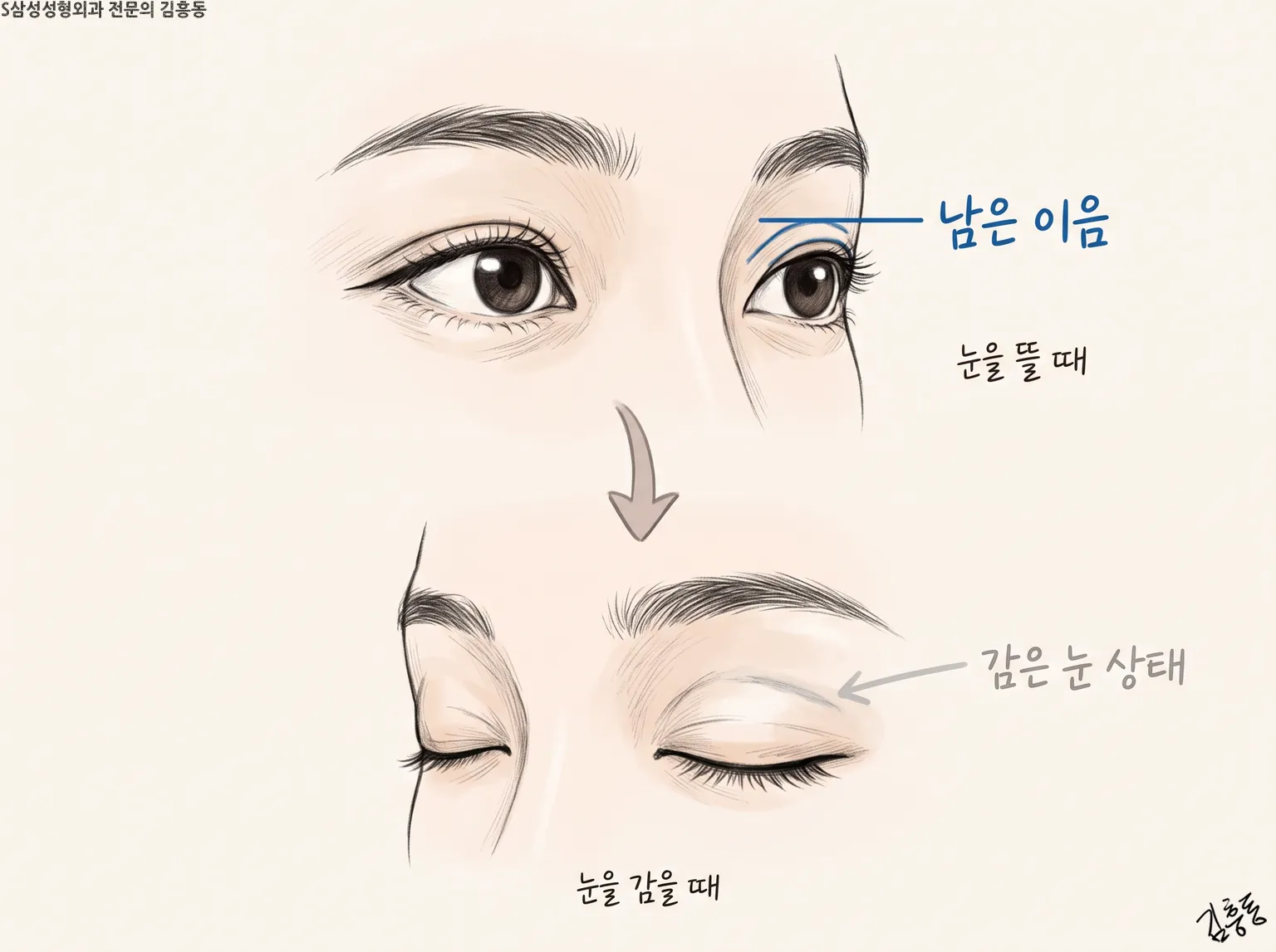 남은 이음 · 눈을 뜰 때 · 눈을 감을 때 글자를 단, 뜬 눈과 감은 눈을 위아래로 둔 그림