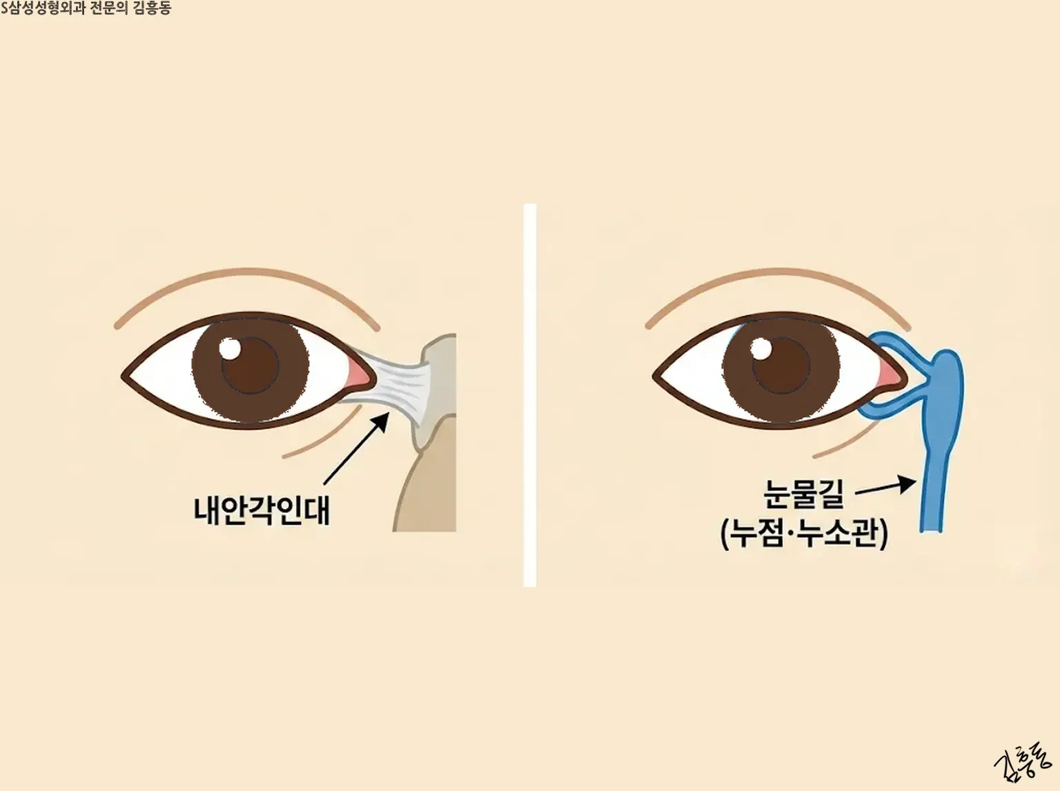 내안각인대와 눈물길(누점 · 누소관)을 두 칸으로 나눠 그린 눈 도식 그림