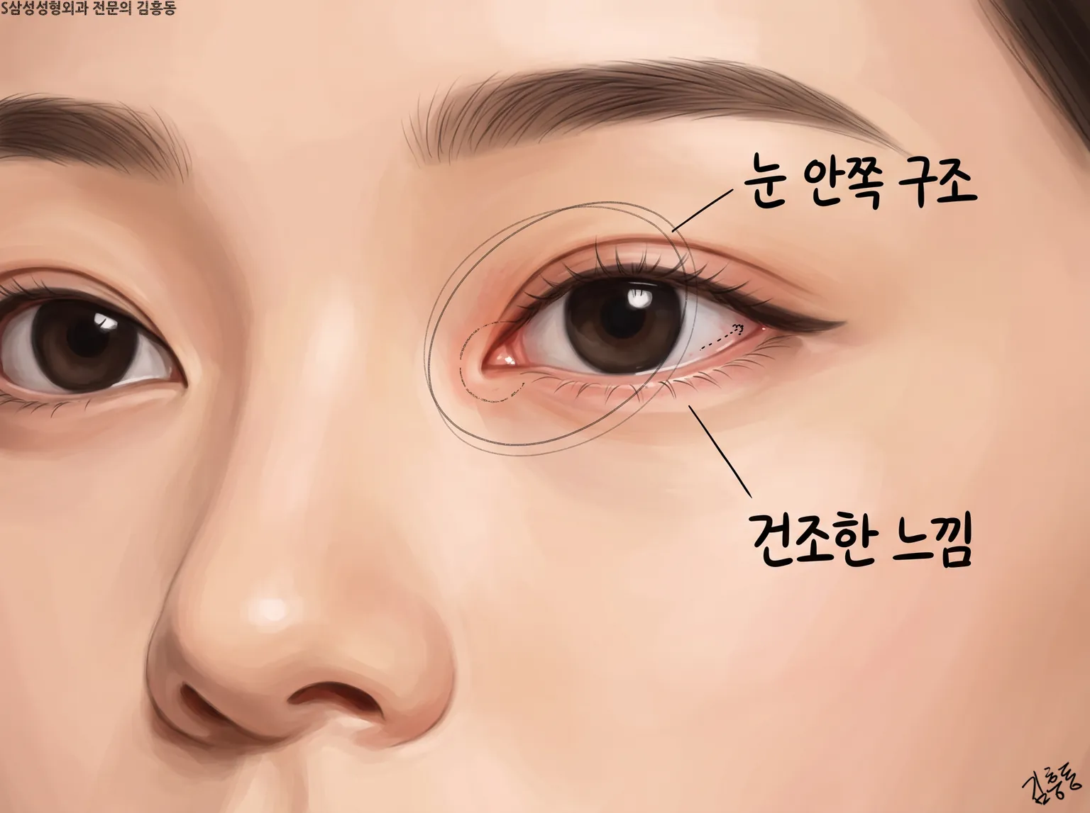 눈 안쪽 구조와 건조한 느낌 이름표를 둥근 선으로 표시한 한쪽 눈 가까이 그림