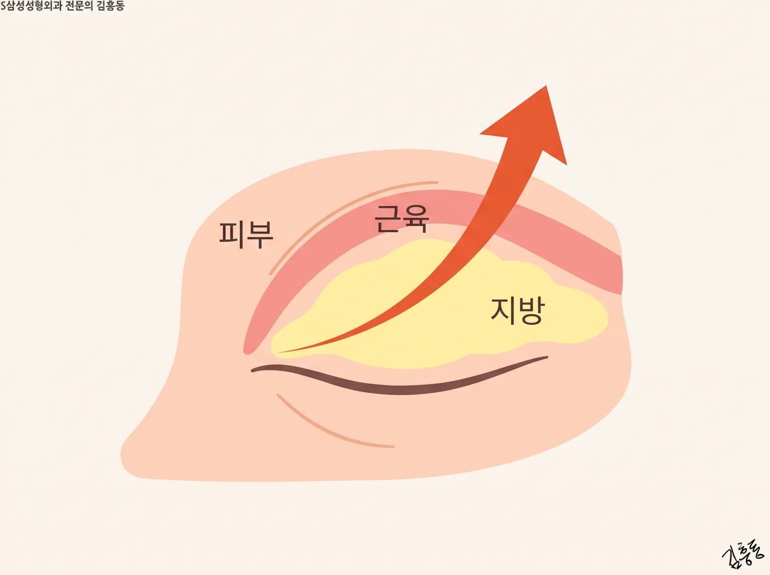 피부 · 근육 · 지방을 표시하고 위로 굽은 화살표를 그린 감은 눈의 눈꺼풀 도식