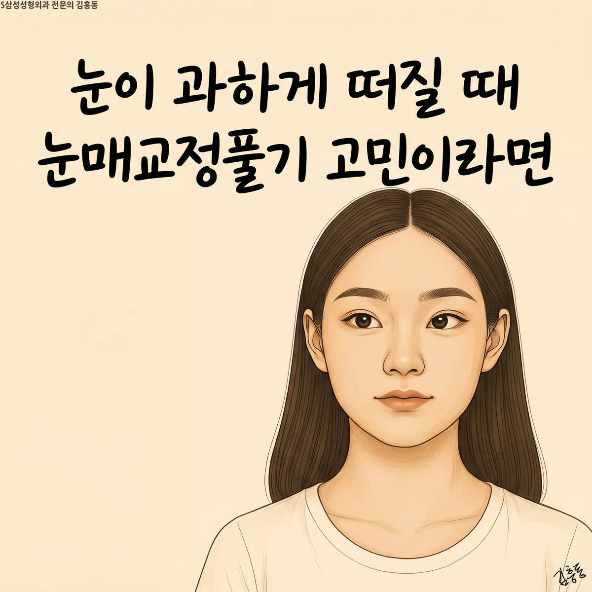 「눈이 과하게 떠질 때 눈매교정풀기 고민이라면」이라는 제목이 적힌, 긴 머리 여성의 정면 얼굴 그림