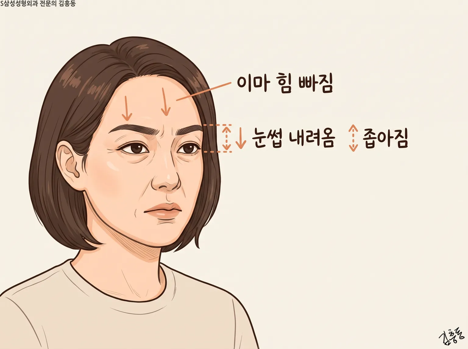 여성 이마와 눈썹에 이마 힘 빠짐 · 눈썹 내려옴 · 좁아짐 이름표와 화살표를 둔 그림