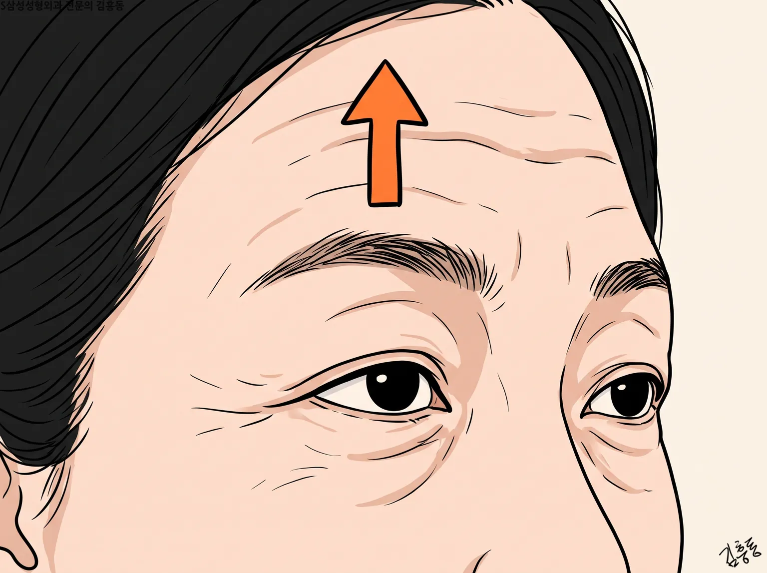 이마에 가로 주름이 지고 눈썹 위에 위로 향한 주황색 화살표가 있는 얼굴 윗부분 그림