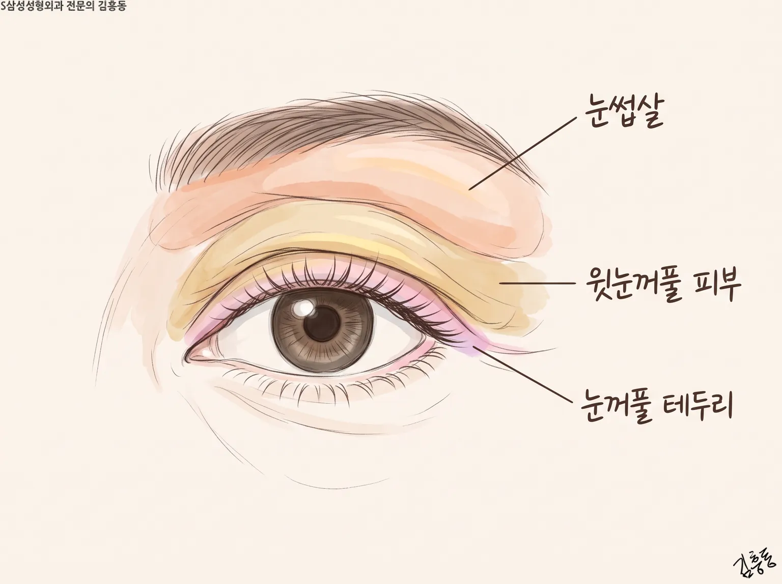 눈썹살 · 윗눈꺼풀 피부 · 눈꺼풀 테두리를 색을 달리해 표시한 한쪽 눈 그림